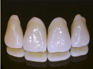 کانال دندانپزشکی